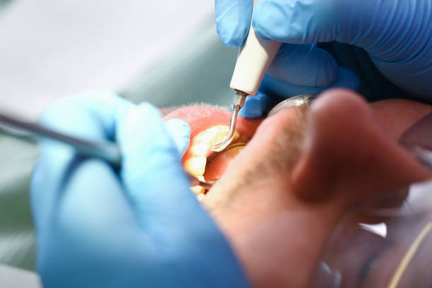 Best Urgent Dental Care for Toothache in Oakwood, GA