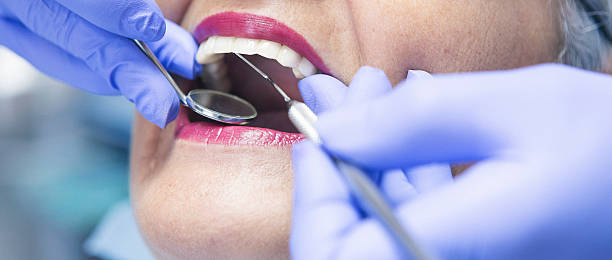 Best Emergency Dental Extractions in Oakwood, GA