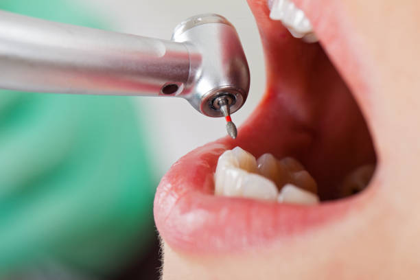 Best Emergency Dentist for Special Needs Patients in Oakwood, GA